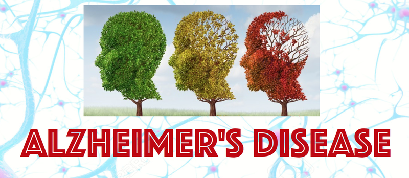 Alzheimer’s Presentation